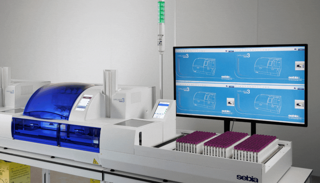 GIF_New Features_SE-1