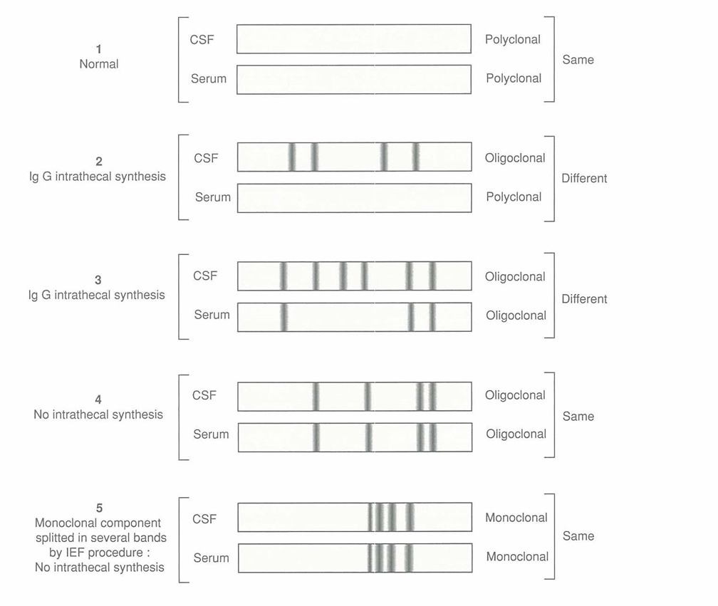 csf-5 types